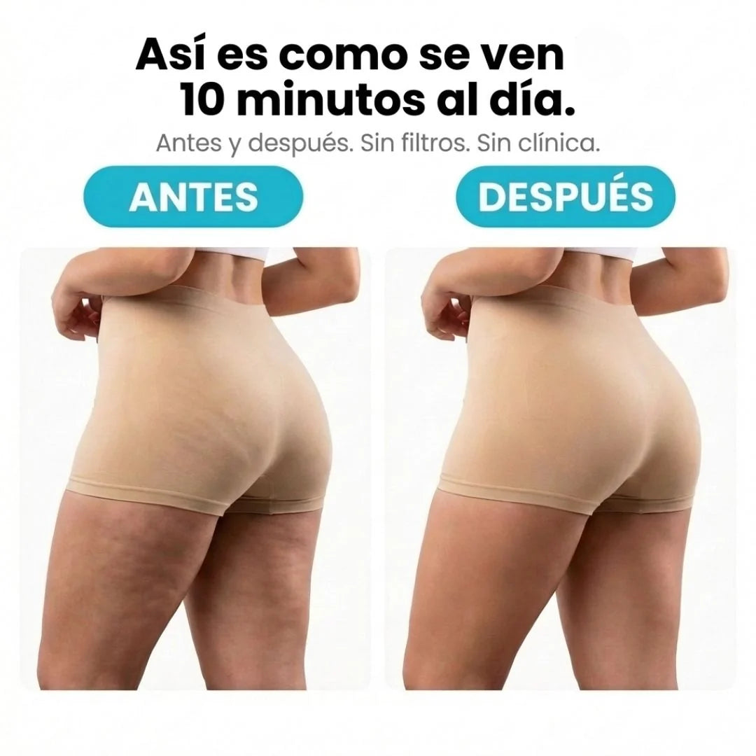 TERSA™ — Masajeador Rotatorio Anticelulitis y Drenaje Linfático