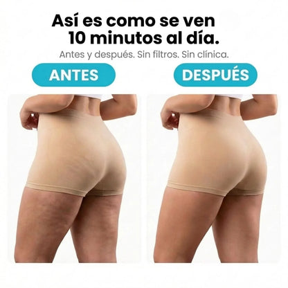 TERSA™ — Masajeador Rotatorio Anticelulitis y Drenaje Linfático